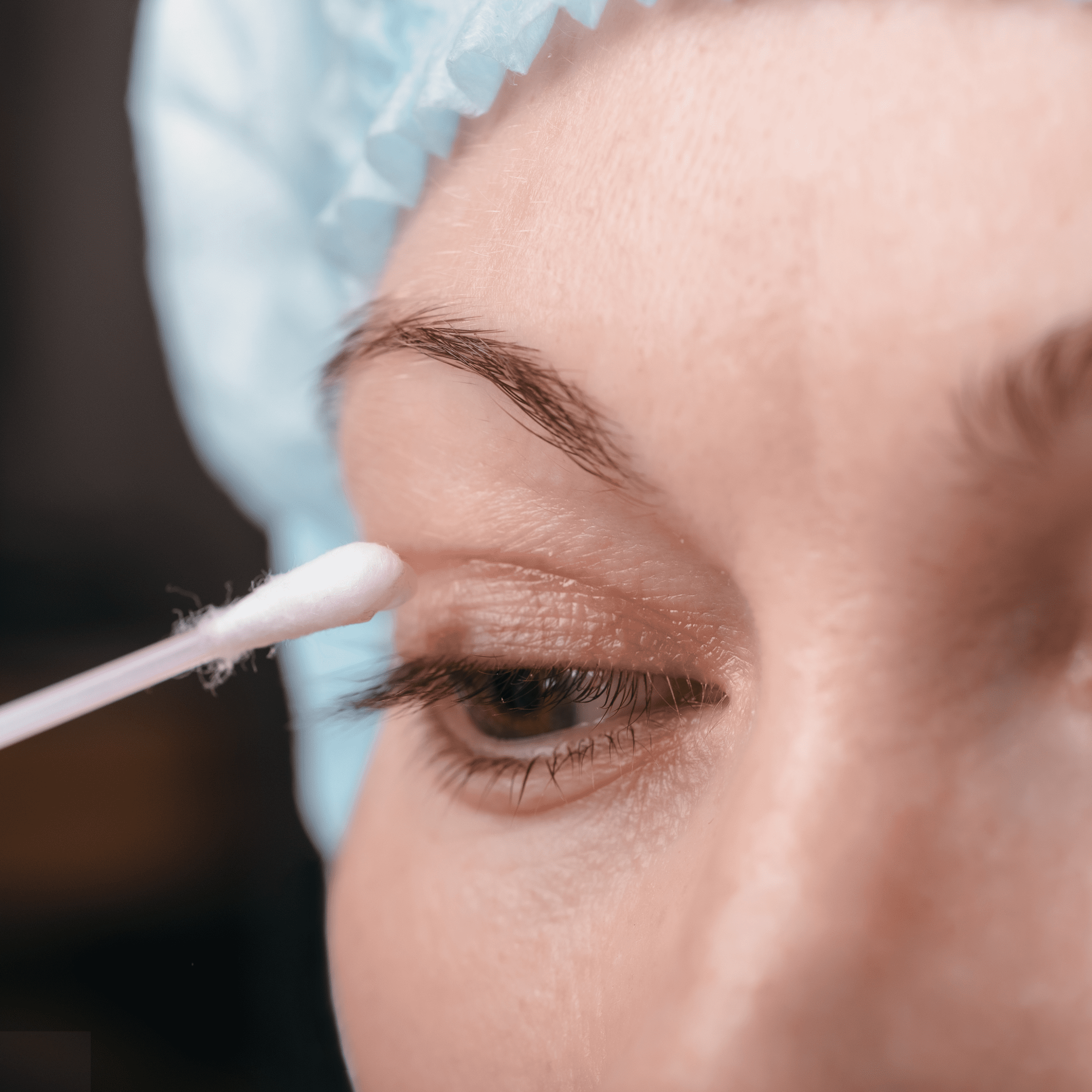 Clarity Eyelid Surgery